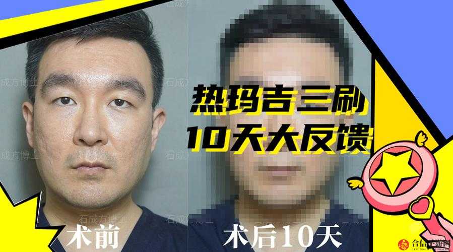 梁医生不可以限不容：其背后的原因及影响究竟如何